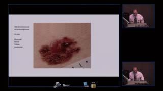 AIM at Melanoma Symposium 2016 Part I