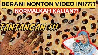 MENGUAK FATA FOBIA TRYPOPHOBIA/KETAKUTAN MELIHAT LUBANG LUBANG