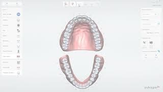 3Shape Treatment Review - Clear aligner case creation (TRIOS Users)