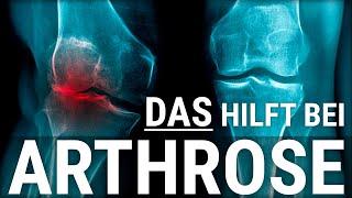 5 Tipps bei ARTHROSE (Omarthrose, Spondylarthrose, Rhizarthrose, Coxarthrose)