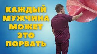 Уздечка полового органа // Что это? И почему столько бед от неё