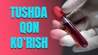 Tushda qon ko'rish | Тушда қон кўриш