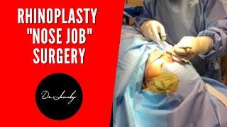 Plastic Surgery In San Antonio Rhinoplasty  by drjeneby