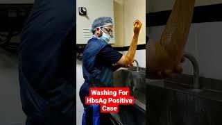 Washing For HbsAg Positive Case...Dr Sai Chandra