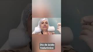 Día de ácido hialurónico ( Porto Alegre) #acidohialuronico  #preenchimentofacial