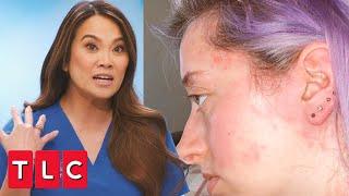 Dr. Lee Sees a Patient With Mast Cell Disease | Dr. Pimple Popper