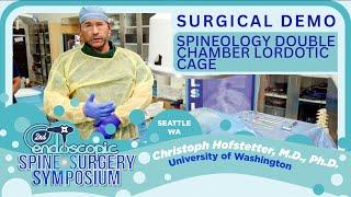 Surgical Demo: Spineology Double Chamber Lordotic Cage - Christoph Hofstetter, M.D. , PhD