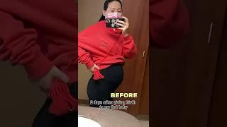 My Belly Transformation After Giving Birth!