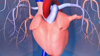 Catheter Ablation: What is it and how does it help an irregular heart beat?