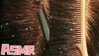 ASMR | My little sister's head itches and can't sleep. She cleans up dandruff in an immersive way.