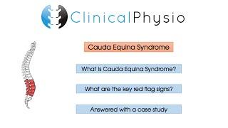 Red Flag Review: Cauda Equina Syndrome | Clinical Physio