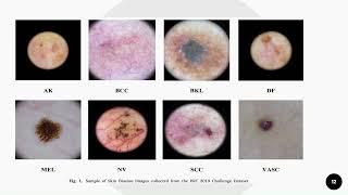 Human Skin Disease Detection Using machine Learning