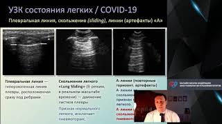 УЗИ легких COVID 19 Кузьков В.В.