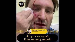 Наложили 14 швов: перенесший операцию после нападения тигра Эдгар Запашный рассказал о последствиях