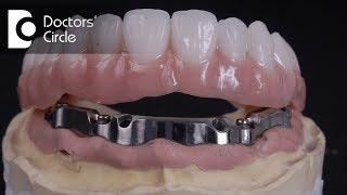 What are Implant Supported Dentures & for how long do they last? - Dr. Manesh Chandra Sharma