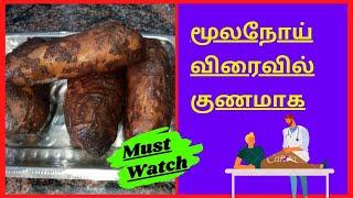 Moolam medicine in Tamil/moolathai seri seivathu eppadi/moolam medicine in Tamil/piles treatment