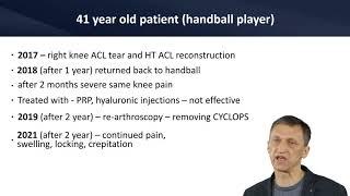 Endoscopic Articular Cartilage Repair in 3rd Arthroscopy after ACL reconstruction