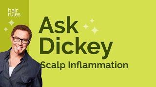 Ask Dickey! E38: Scalp Inflammation