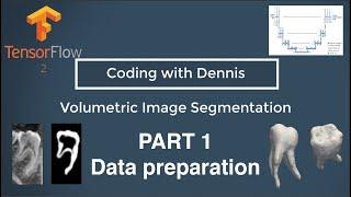 3D Image Segmentation (CT/MRI) with a 2D UNET - Part1: Data preparation