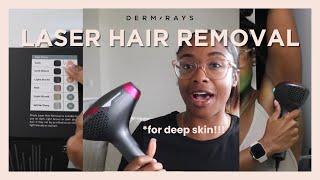 The World's First At-Home Laser Hair Removal for Deep Skins! | Is it worth it? @DanielleShantal