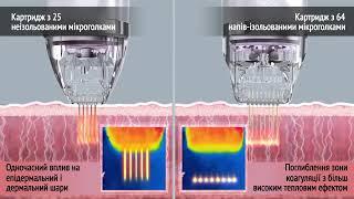 ILOODA SECRET RF - cуперсучасне рішення для омолодження шкіри з миттєвими результатами