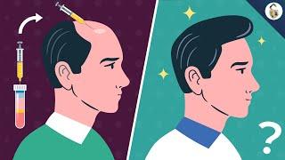 Does PRP Work For Hair Loss In Men?