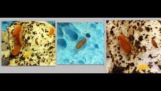 Giant Orange Isopods and Springtails in HD
