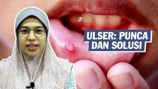 Ulser: Punca dan Solusi