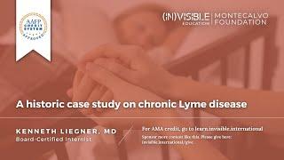 A historic case study on chronic Lyme disease