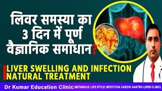 LIVER SWELLING AND INFECTION NATURAL TREATMENT// लिवर समस्या का 3 दिन में पूर्ण वैज्ञानिक समाधान?