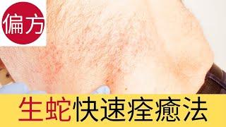 生蛇快速痊癒法