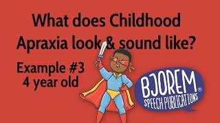 Childhood Apraxia of Speech - Example #3