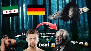 Man Deaf age 23 Face change Tommorow  ‍