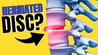 Wonder if you have a Herniated Disc?? Try this One Simple Test.