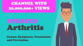 Arthritis - Causes, Symptoms, Treatments and Prevention