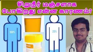 சிறுநீர் ஏன் மஞ்சளாக போனால் Kidneyக்கு ஆபத்தா?தீர்வு என்ன? Why Urine appears Yellow? Mightymedicoz