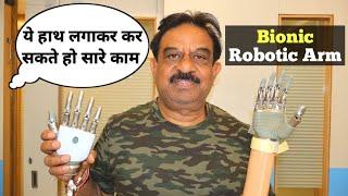 Prosthetic Hand  | ये हाथ लगवाकर आप कर सकते हैं सारे काम  | Myoelectric hand , Bionic Robotic Arm