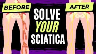 Why Sciatica Happens and How to Fix It!