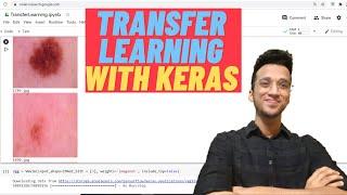 Transfer Learning Using CNN(VGG 16)| Keras Tutorial|