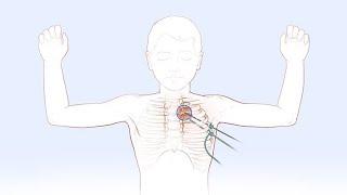 Sympathectomy CPT code - simplify medical coding