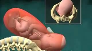 Видео ролик 3D модель прохождения плода по половым путям при родах  Посмотреть видео 3D модель прохо
