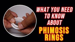 What you need to know about PHIMOSIS RINGS