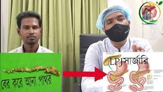 প্যানক্রিয়াসের পাথরের চিকিৎসা ও সার্জারির পরে রোগীর অনুভূতি | Dr.mustafizur Rahamn