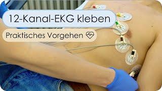 Anlage eines 12-Kanal-EKG (Skills, EKG kleben, EKG-Elektroden, Reihenfolge, EKG-Auswertung)