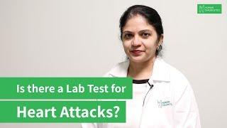 Prevent Heart Attacks with this Lab Test