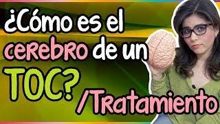 ¿Cómo es el cerebro de un TOC? | Tratamiento