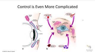 [Online Seminar] Art Epstein: Dry Eye: A Simple Approach to In-Depth Understanding