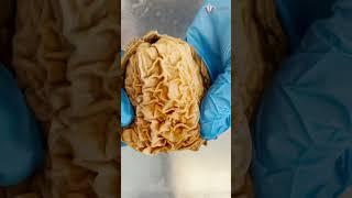 Looking Inside a Real Human Stomach | #shorts #food