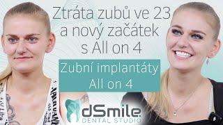 Šok ve 23 letech: Jak jsem získala nový úsměv s All on 4 od dSmile #implant #dentist #dsmile