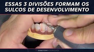 ESSAS 3 FORMAÇÕES FORMAM OS SULCOS DE DESENVOLVIMENTO | Ginetom Rodrigues